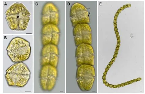  Gymnodinium: Ein mikroskopischer Pirat der Meere!